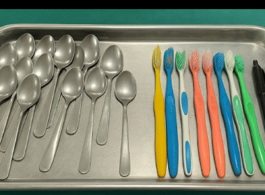 Doctors Remove 29 Spoons, 19 Toothbrushes & 2 Pens from UP Man’s Stomach