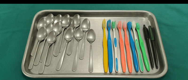 Doctors Remove 29 Spoons, 19 Toothbrushes & 2 Pens from UP Man’s Stomach