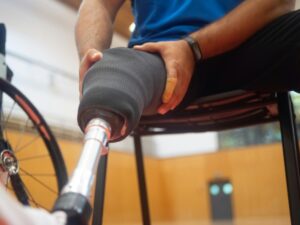 Scientists use AI to develop bone-like materials for stronger hip replacements