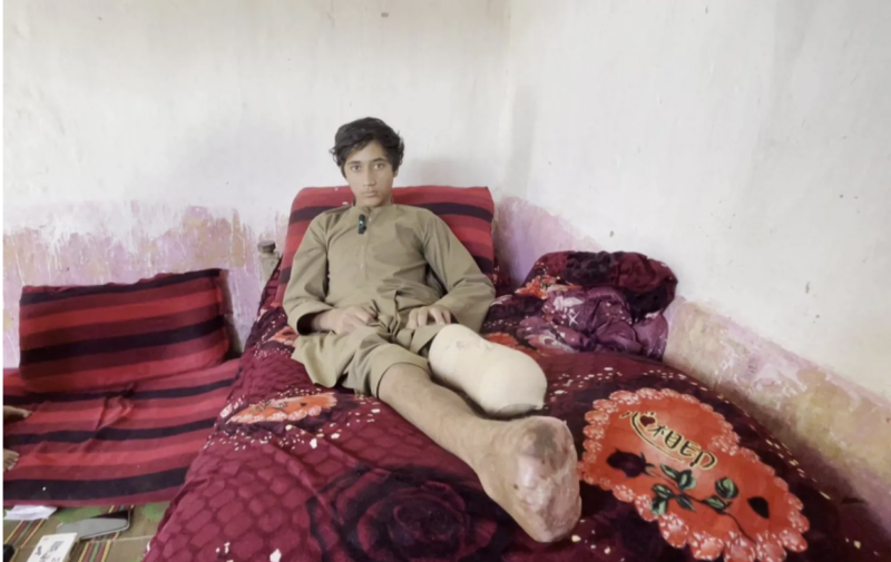 11 Afghan Migrants Lose Limbs to Frostbite After Alleged Turkey Border Pushback, BBC Investigation Reveals
